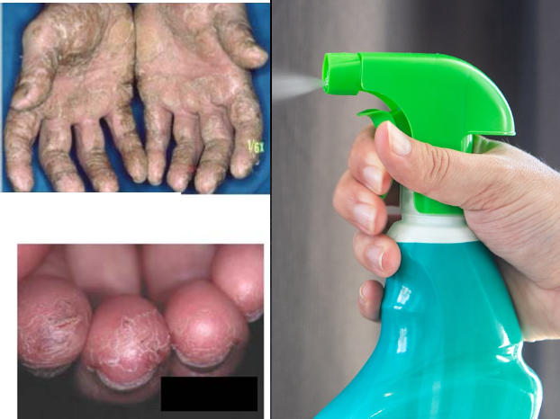 L'usage de désinfectants : quels risques pour la santé ? 